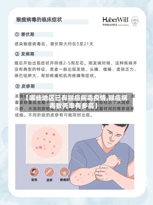 【哪些地区已有猴痘病毒疫情,猴痘病毒致死率有多高】