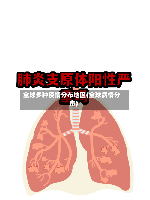 全球多种疫情分布地区(全球病情分布)